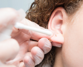Ear Hole Closure & Re-Piercing