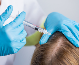 Mesotherapy for Stronger Hair