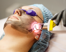Laser Skin Rejuvenation Treatment