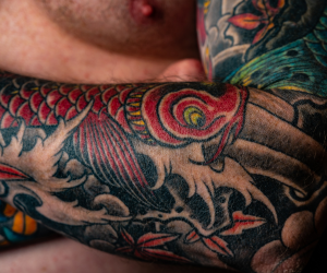 Multi-Color Tattoo Removal