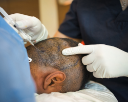 Post-Hair Transplant Maintenance Program