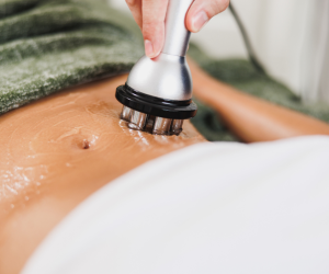 RF Skin Tightening & Cellulite Reduction