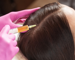 PRP Hair Fall Control Therapy