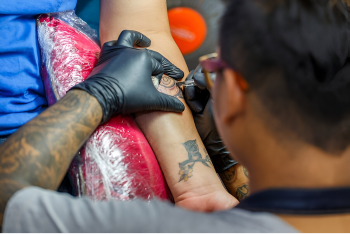 Tattoo Removal